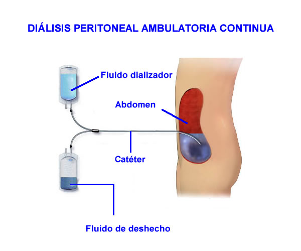 TÉCNICAS DOMICILIARIAS DE LA IRC: DIÁLISIS PERITONEAL Y HEMODIÁLISIS DOMICILIARIA. 3ª Edición