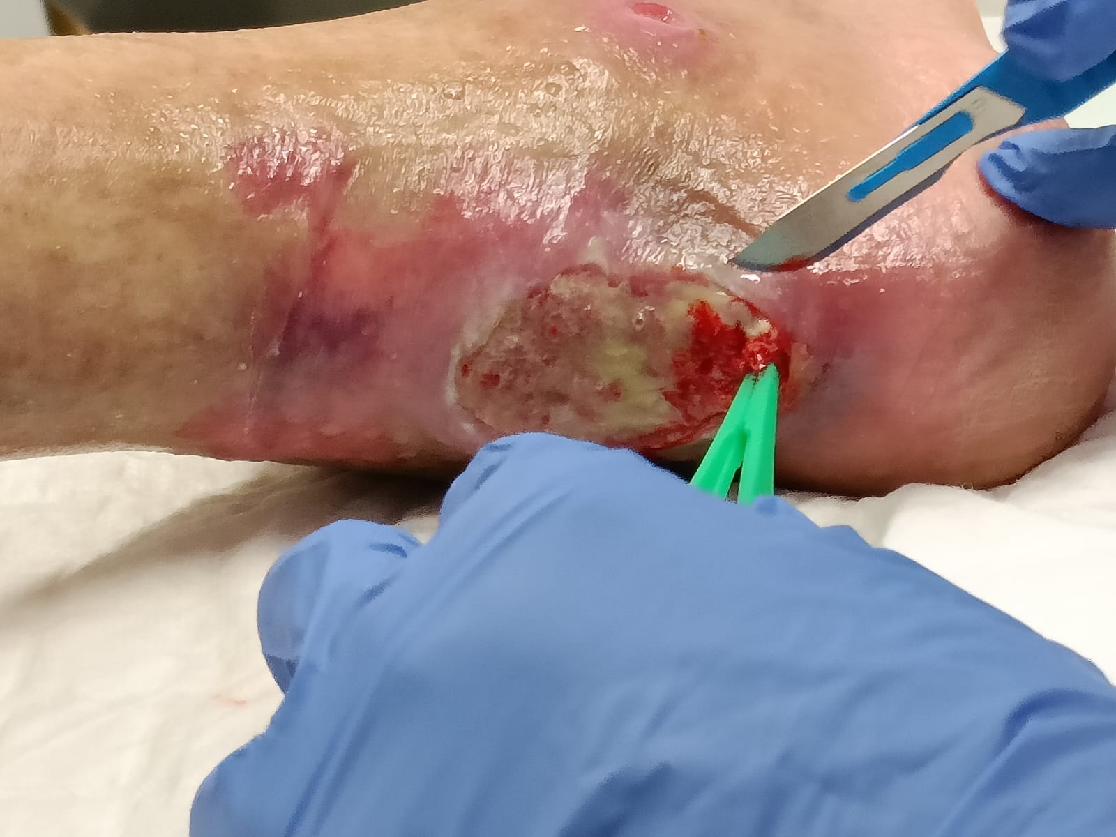 Jornadas. Piel y heridas: una visión integral del cuidado enfermero