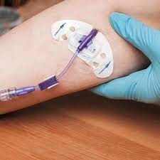 CUIDADOS DE ENFERMERÍA EN EL MANEJO DE ACCESOS VENOSOS CENTRALES: PICC Y RESERVORIO