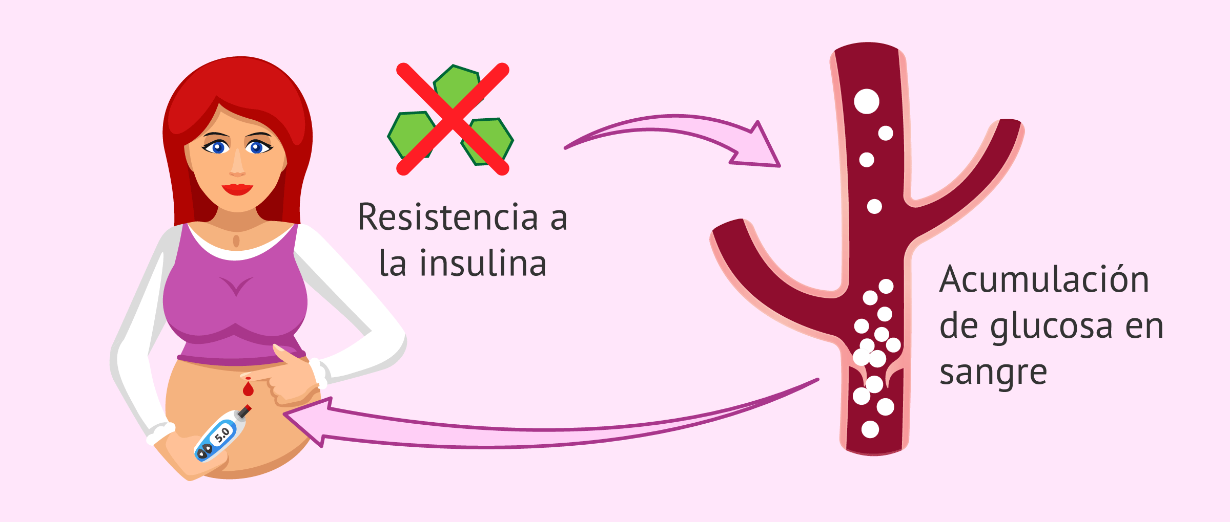 DIABETES GESTACIONAL PARA MATRONAS