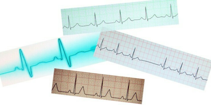 ACTUALIZACIÓN DE ENFERMERÍA EN ELECTROCARDIOGRAMAS-ECG 